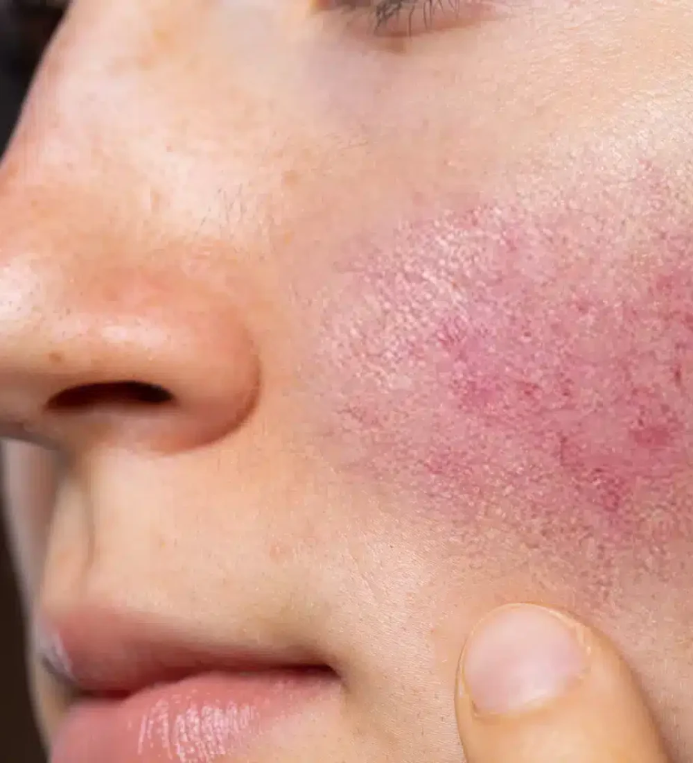 Hudlæge uden ventetid