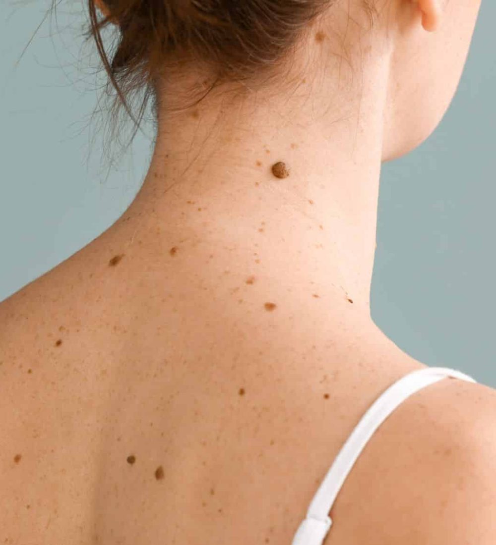 hudlæge uden ventetid